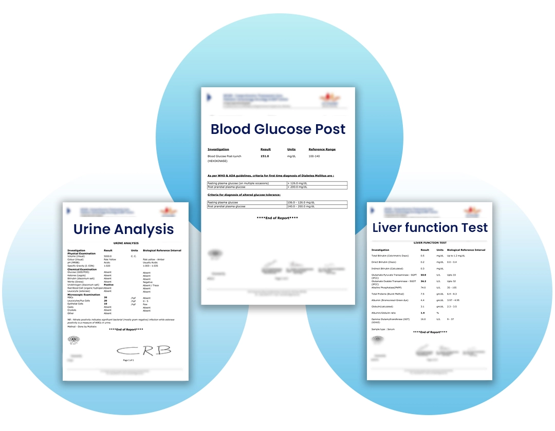Lab management system report samples including blood glucose and liver function test